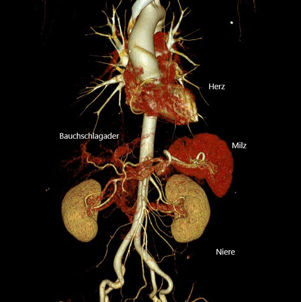 CT 7 CT bauchraum