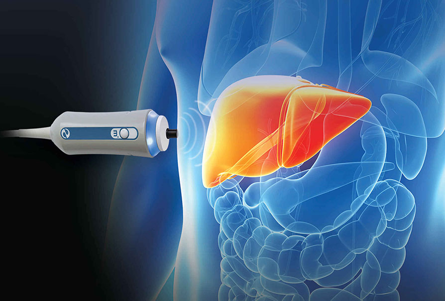 ROE Fibroscan