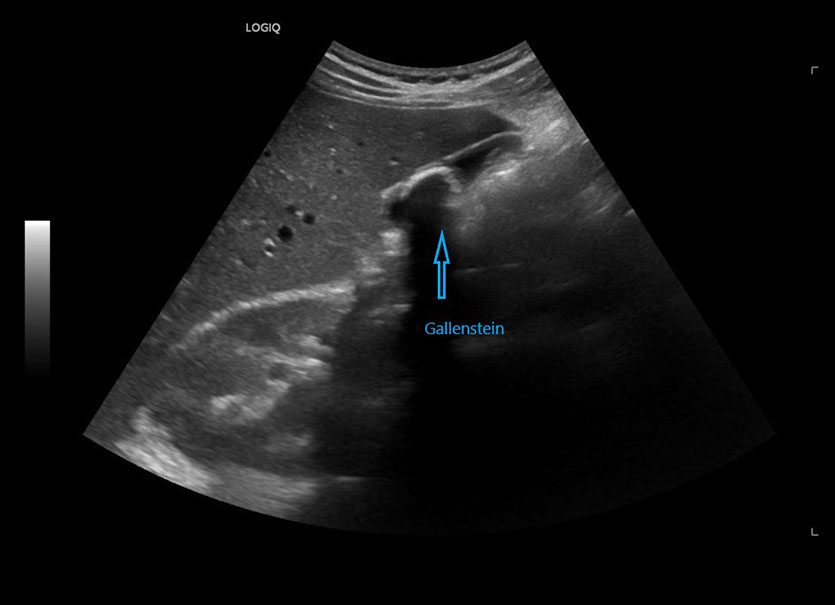 Ultraschall Bauchorgane